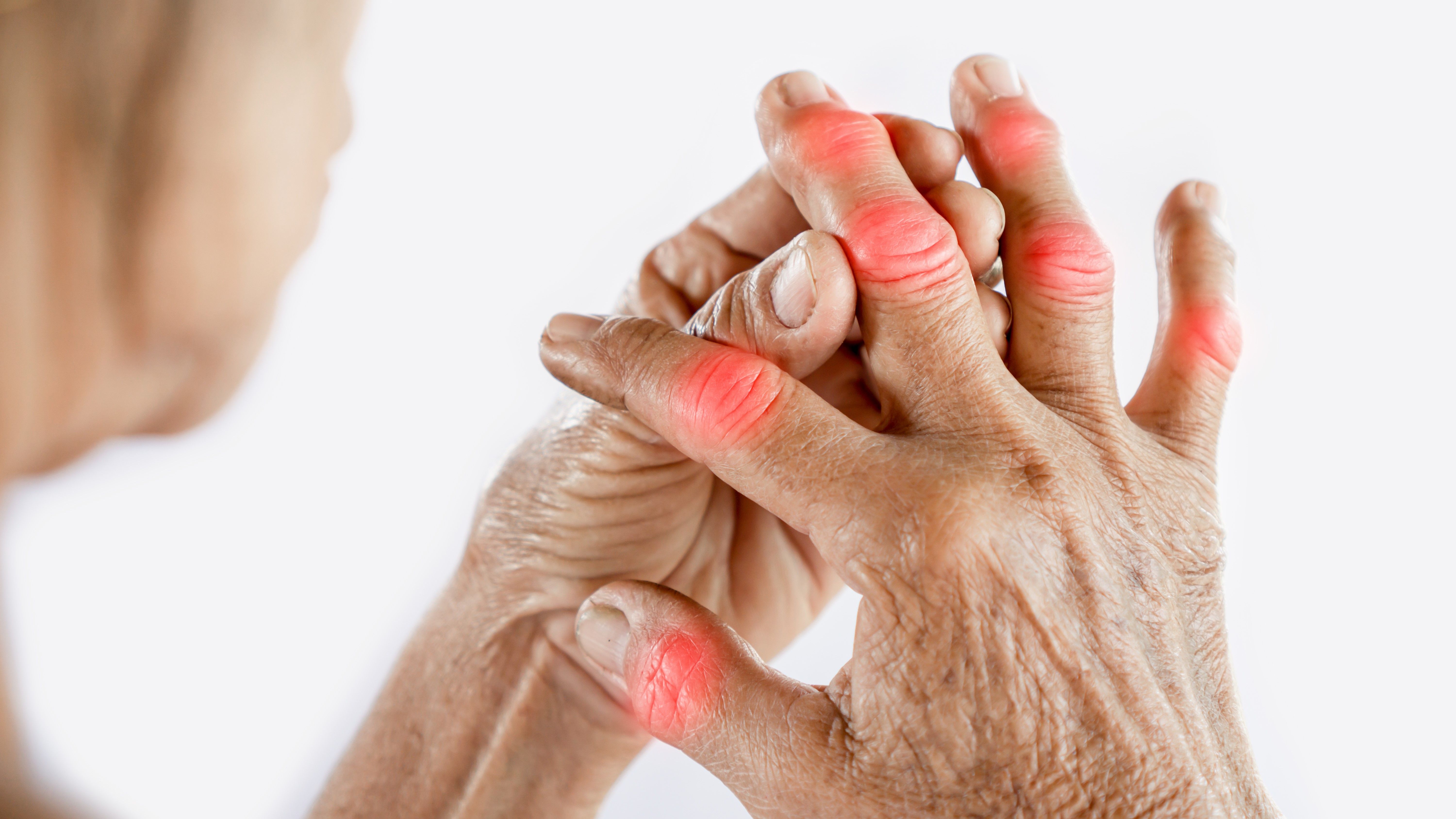 Arthritis & Joint Pain