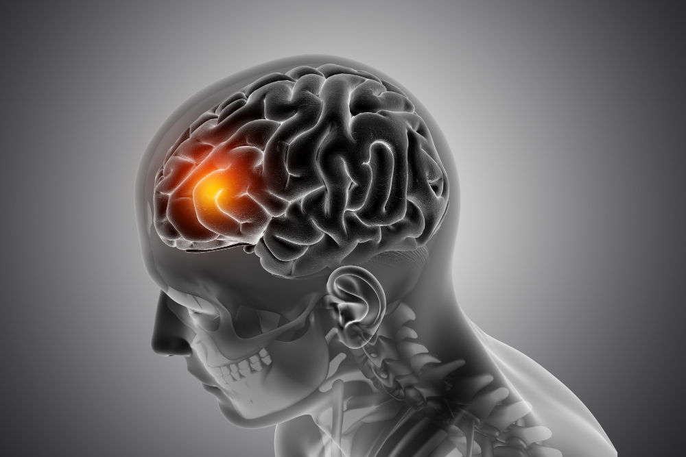 Neurological Conditions Treatment