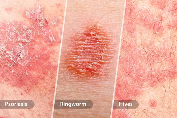 Skin Conditions Treatment