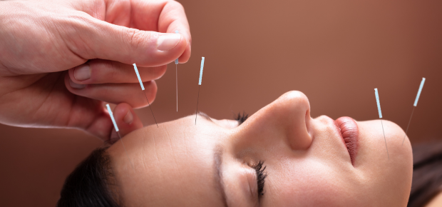 Diploma in Acupuncture